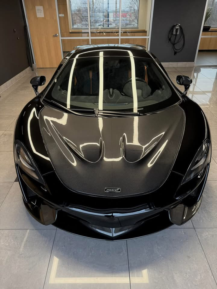 P1 Style Carbon Fiber Vented Hood Bonnet - McLaren 570s/570GT/540C/600LT